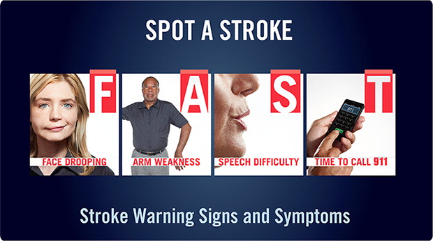 Signs of a Stroke